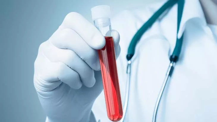 Why a blood test before and after your surgery is crucial